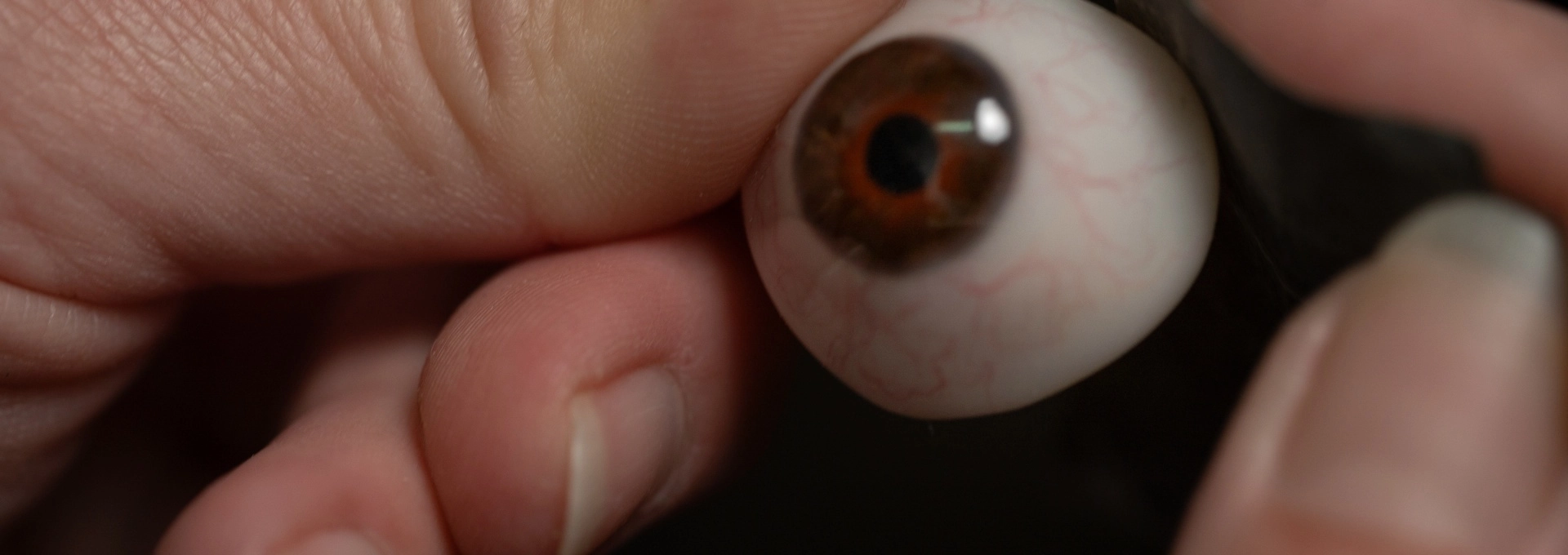 quelles-sont-les-principales-causes-medicales-qui-conduisent-a-poser-une-prothese-oculaire